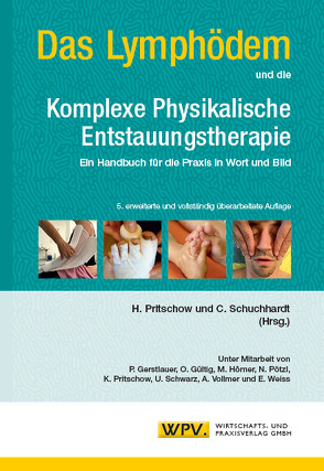 Das Lymphödem und die Komplexe Physikalische Entstauungstherapie von Pritschow,  Hans, Schuchhardt,  Christian