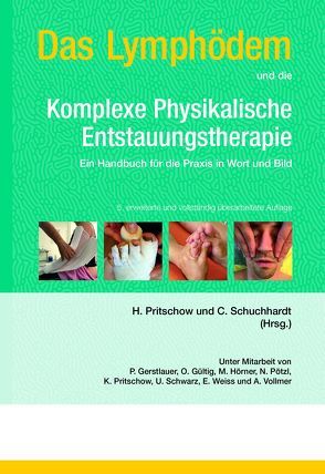 Das Lymphödem und die Komplexe Physikalische Entstauungstherapie von Pritschow,  Hans, Schuchhardt,  Christian