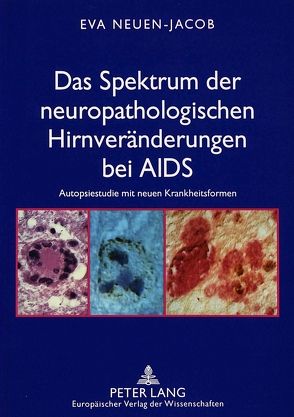 Das Spektrum der neuropathologischen Hirnveränderungen bei AIDS von Neuen-Jacob,  Eva