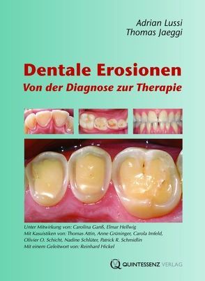 Dentale Erosionen von Jaeggi,  Thomas, Lussi,  Adrian
