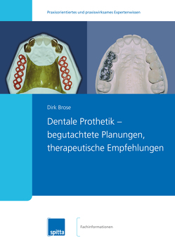 Dentale Prothetik ? begutachtete Planungen, therapeutische Empfehlungen von Brose,  Dirk