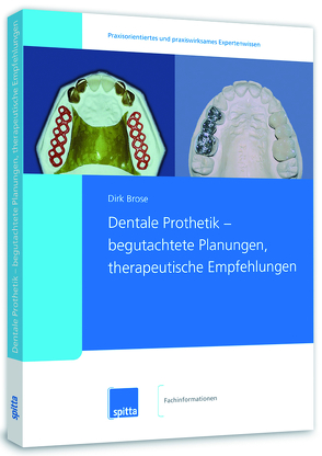 Dentale Prothetik – begutachtete Planungen, therapeutische Empfehlungen von Brose,  Dirk