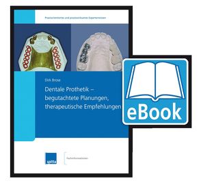 Dentale Prothetik – begutachtete Planungen, therapeutische Empfehlungen von Brose,  Dirk