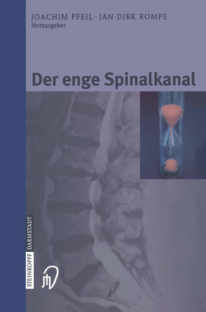 Der enge Spinalkanal von Pfeil,  Joachim, Rompe,  Jan-Dirk