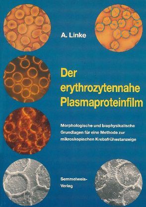 Der erythrozytennahe Plasmaproteinfilm von Linke,  Arno