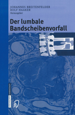 Der lumbale Bandscheibenvorfall von Breitenfelder,  J., Breitenfelder,  M., Haaker,  R.