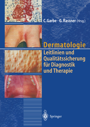 Dermatologie von Garbe,  C., Rassner,  G.