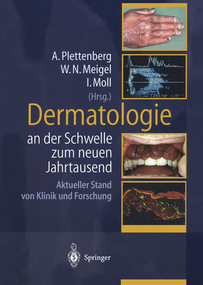 Dermatologie an der Schwelle zum neuen Jahrtausend von Albrecht,  D., Hattendorf,  C., Lorenzen,  T., Meigel,  W.N., Moll,  I., Plettenberg,  A.