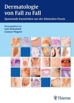 Dermatologie von Fall zu Fall von Kowalzick,  Lutz, Wagner,  Gunnar