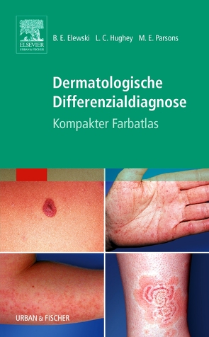 Dermatologische Differenzialdiagnose von Elewski,  Boni E., Hughey,  Lauren, Parsons,  Margaret