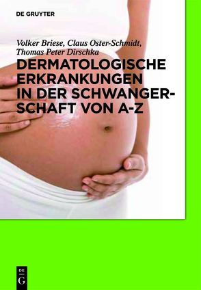 Dermatologische Erkrankungen in der Schwangerschaft von A-Z von Briese,  Volker, Dirschka,  Thomas Peter, Oster-Schmidt,  Claus