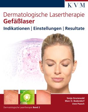Dermatologische Lasertherapie Band 2: Gefäßlaser von Bodendorf,  Marc Oliver, Grunewald,  Sonja, Paasch,  Uwe