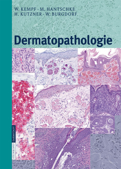 Dermatopathologie von Burgdorf,  W., Hantschke,  Markus, Kempf,  W., Kutzner,  H.