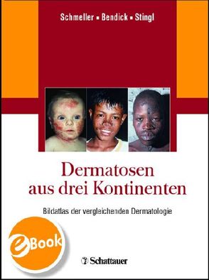 Dermatosen aus drei Kontinenten von Bendick,  Christoph, Schmeller,  Wilfried, Stingl,  Peter