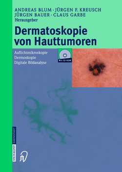 Dermatoskopie von Hauttumoren von Bauer,  J., Blum,  A., Garbe,  C., Kreusch,  J.F.