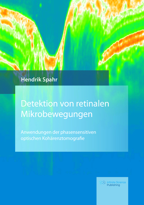 Detektion von retinalen Mikrobewegungen von Spahr,  Hendrik