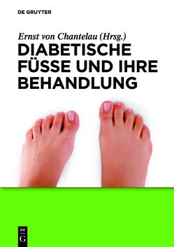 Diabetische Füße und ihre Behandlung von Chantelau,  Ernst