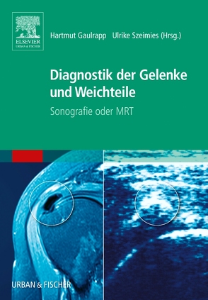 Diagnostik der Gelenke und Weichteile von Gaulrapp,  Hartmut, Szeimies,  Ulrike