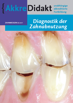 Diagnostik der Zahnabnutzung von Lobbezoo,  Frank, Wetselaar,  Peter