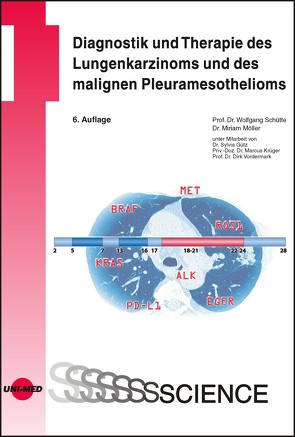 Diagnostik und Therapie des Lungenkarzinoms und des malignen Pleuramesothelioms von Möller,  Miriam, Schütte,  Wolfgang