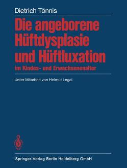 Die angeborene Hüftdysplasie und Hüftluxation im Kindes- und Erwachsenenalter von Legal,  H., Tönnis,  D.