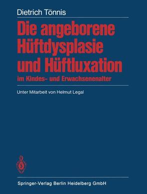 Die angeborene Hüftdysplasie und Hüftluxation im Kindes- und Erwachsenenalter von Legal,  H., Tönnis,  D.
