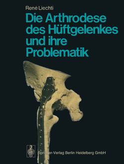Die Arthrodese des Hüftgelenkes und ihre Problematik von Liechti,  R., Müller,  M.E., Weber,  B. G.