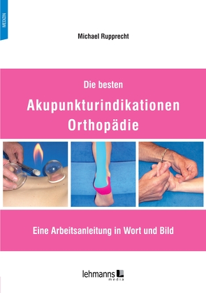 Die besten Akupunkturindikationen Orthopädie von Rupprecht,  Michael