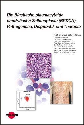 Die Blastische plasmazytoide dendritische Zellneoplasie (BPDCN) – Pathogenese, Diagnostik und Therapie von Klemke,  Claus-Detlev