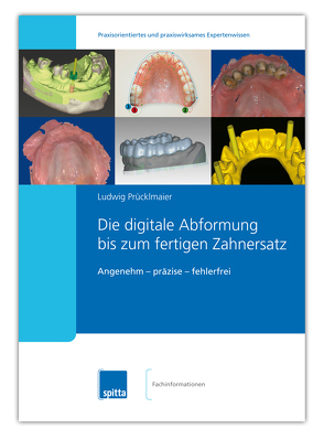 Die digitale Abformung bis zum fertigen Zahnersatz von Prücklmaier,  Ludwig
