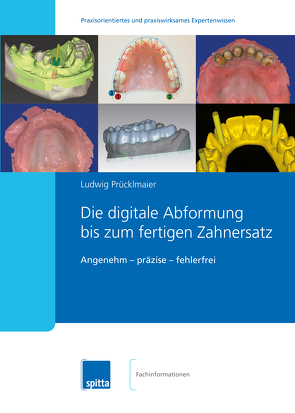 Die digitale Abformung bis zum fertigen Zahnersatz von Prücklmaier,  Ludwig