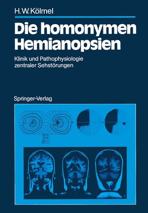 Die homonymen Hemianopsien von Kölmel,  Hans W.