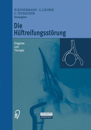 Die Hüftreifungsstörung von Gruber,  Gerd, Konermann,  Werner, Tschauner,  Christian