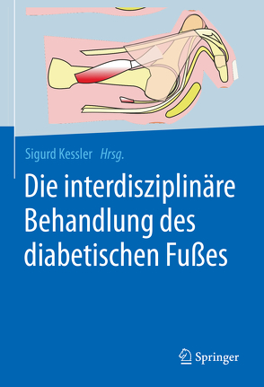 Die interdisziplinäre Behandlung des diabetischen Fußes von Kessler,  Sigurd