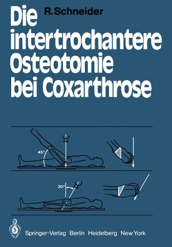 Die intertrochantere Osteotomie bei Coxarthrose von Schneider,  R