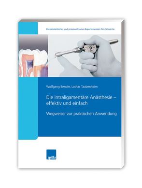 Die intraligamentäre Anästhesie – effektiv und einfach von Bender,  Wolfgang, Taubenheim,  Lothar