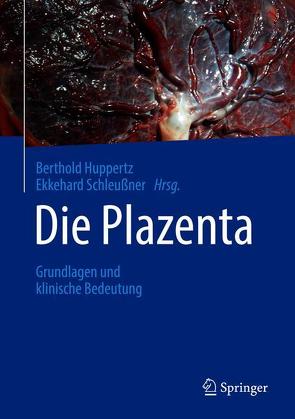 Die Plazenta von Huppertz,  Berthold, Schleussner,  Ekkehard