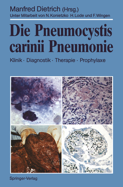 Die Pneumocystis carinii Pneumonie von Dietrich,  Manfred, Konietzko,  N., Lode,  H., Wingen,  F.
