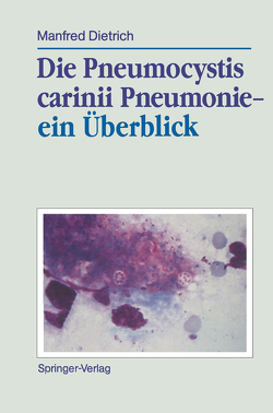 Die Pneumocystis carinii Pneumonie— ein Überblick von Dietrich,  Manfred