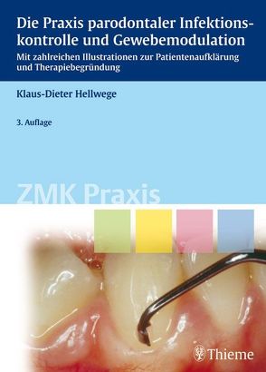 Die Praxis parodontaler Infektionskontrolle und Gewebemodulation von Hellwege,  Klaus-Dieter