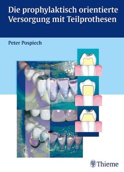 Die prophylaktisch orientierte Versorgung mit Teilprothesen von Pospiech,  Peter