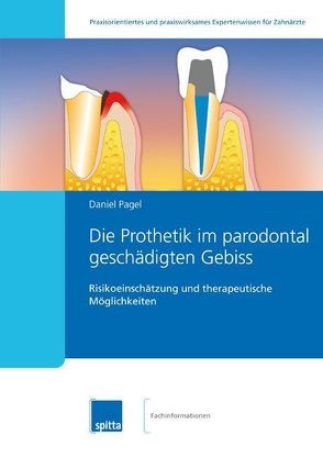 Die Prothetik im parodontal geschädigten Gebiss von Pagel,  Daniel