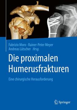 Die proximalen Humerusfrakturen von Lütscher,  Andreas, Meyer,  Rainer-Peter, Moro,  Fabrizio