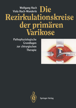 Die Rezirkulationskreise der primären Varikose von Hach,  Wolfgang, Hach-Wunderle,  Viola