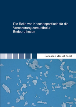 Die Rolle von Knochenpartikeln für die Verankerung zementfreier Endoprothesen von Zobel,  Sebastian Manuel