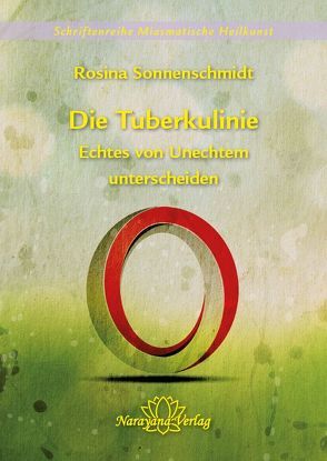 Die Tuberkulinie – Echtes von Unechtem unterscheiden – Band 4 von Sonnenschmidt,  Rosina