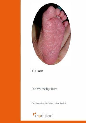 Die Wunschgeburt von Ulrich,  A.