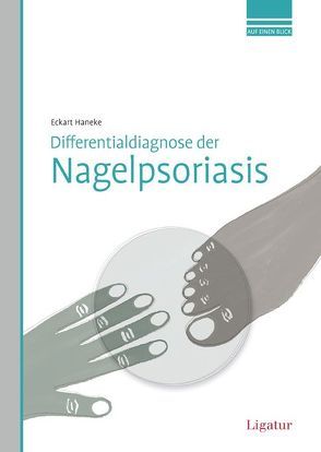 Differentialdiagnose der Nagelpsoriasis von Haneke,  Eckart