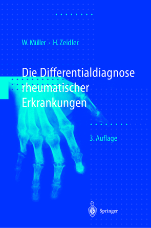 Differentialdiagnose rheumatischer Erkrankungen von Mueller,  Wolfgang, Müller,  W., Schilling,  F., Wagenhäuser,  F.J., Zeidler,  Henning