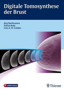 Digitale Tomosynthese der Brust von Barkhausen,  Jörg, Rody,  Achim, Schäfer,  Fritz K.W.